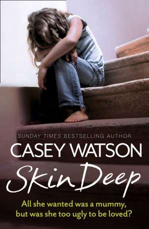 Skin Deep: All She Wanted Was a Mummy, But Was She Too Ugly to Be Loved? de Casey Watson