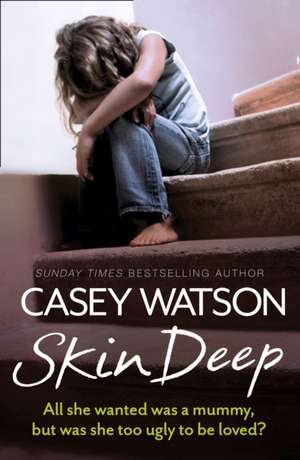 Watson, C: Skin Deep