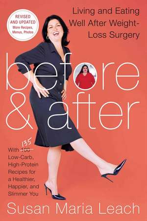 Before & After, Second Revised Edition: Living and Eating Well After Weight-Loss Surgery de Susan Maria Leach