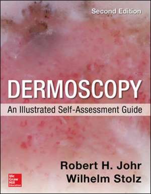 Dermoscopy: An Illustrated Self-Assessment Guide, 2/e de Robert Johr