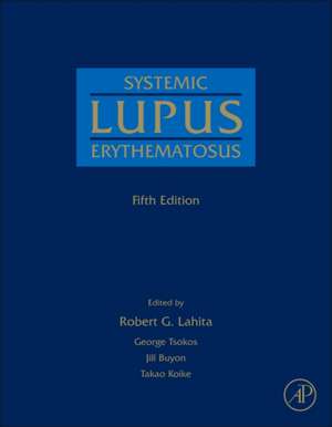 Systemic Lupus Erythematosus de Robert G. Lahita