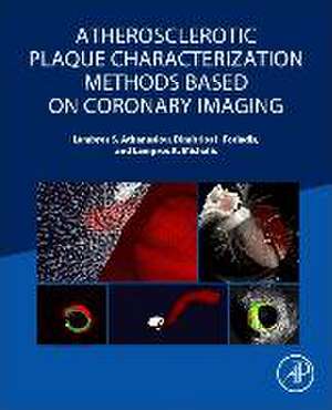 Atherosclerotic Plaque Characterization Methods Based on Coronary Imaging de Lambros S Athanasiou