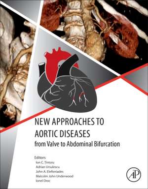 New Approaches to Aortic Diseases from Valve to Abdominal Bifurcation de Ion C. Tintoiu