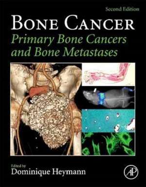 Bone Cancer de Dominique Heymann