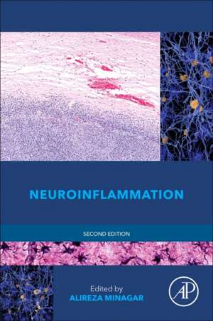 Neuroinflammation de Alireza Minagar