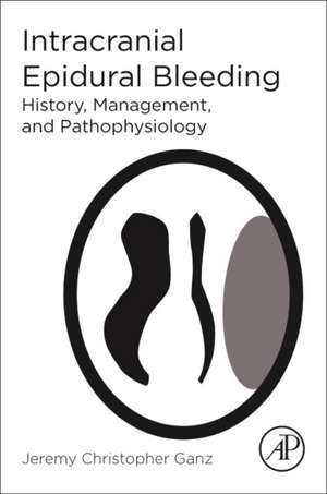 Intracranial Epidural Bleeding: History, Management, and Pathophysiology de Jeremy Christopher Ganz