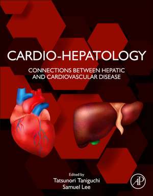 Cardio-Hepatology: Connections Between Hepatic and Cardiovascular Disease de Tatsunori Taniguchi