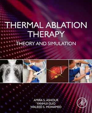 Thermal Ablation Therapy: Theory and Simulation de Amira S. Ashour