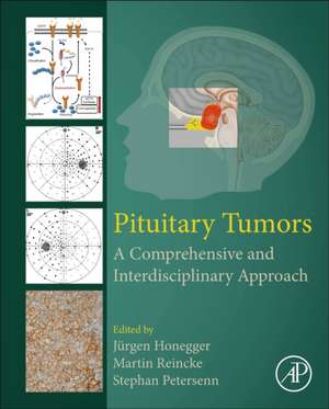 Pituitary Tumors: A Comprehensive and Interdisciplinary Approach de Jürgen Honegger