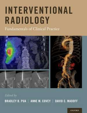 Interventional Radiology: Fundamentals of Clinical Practice de Bradley B. Pua