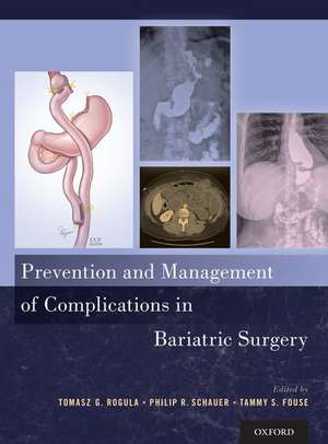 Prevention and Management of Complications in Bariatric Surgery de Tomasz G. Rogula