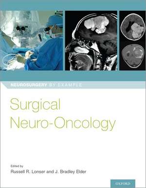 Surgical Neuro-Oncology de Russell R. Lonser