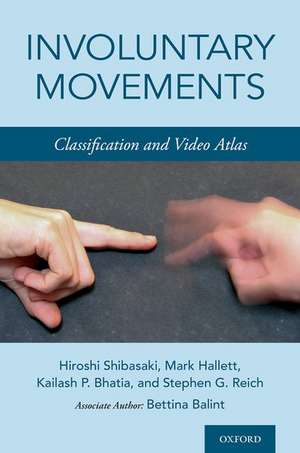 Involuntary Movements: Classification and Video Atlas de Hiroshi Shibasaki