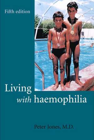 Living with Haemophilia de Peter Jones