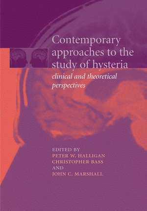 Contemporary Approaches to the Study of Hysteria: Clinical and Theoretical Perspectives de Peter Halligan