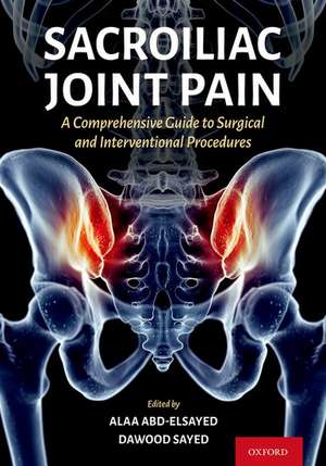 Sacroiliac Joint Pain: A Comprehensive Guide to Interventional and Surgical Procedures de Alaa Abd-Elsayed