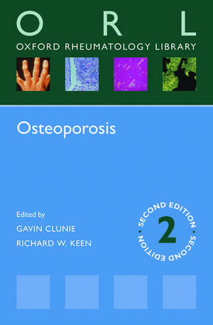 Osteoporosis de Gavin Clunie