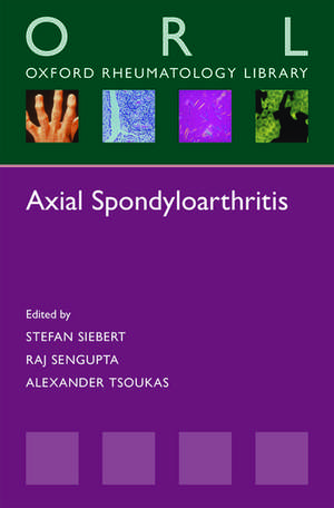 Axial Spondyloarthritis de Stefan Siebert