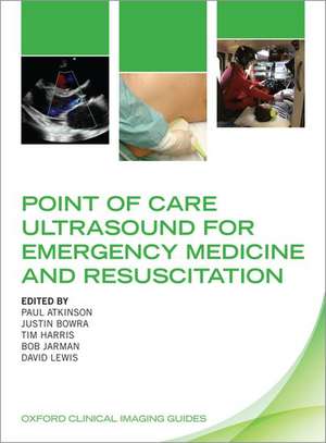 Point of Care Ultrasound for Emergency Medicine and Resuscitation de Paul Atkinson