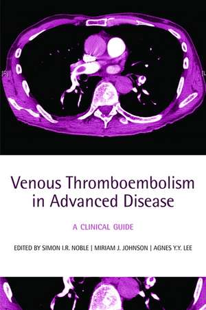 Venous Thromboembolism in Advanced Disease: A clinical guide de Simon I R Noble