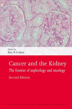 Cancer and the Kidney: The frontier of nephrology and oncology de Eric P. Cohen