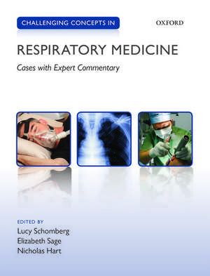 Challenging Concepts in Respiratory Medicine: Cases with Expert Commentary de Lucy Schomberg