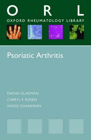 Psoriatic Arthritis de Dafna Gladman