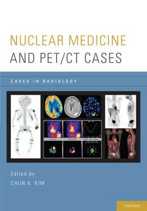 Nuclear Medicine and PET/CT Cases de Chun K. Kim