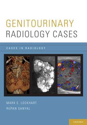 Genitourinary Radiology Cases de Mark E. Lockhart