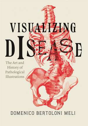 Visualizing Disease: The Art and History of Pathological Illustrations de Domenico Bertoloni Meli