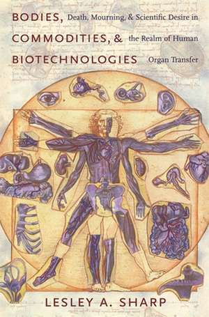 Bodies Commodities and Biotechnologies – Death, Mourning and Scientific Desire in the Realm of Human Organ Transfer de Lesley Sharp