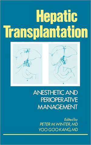 Hepatic Transplantation: Anesthetic and Perioperative Management de Winter