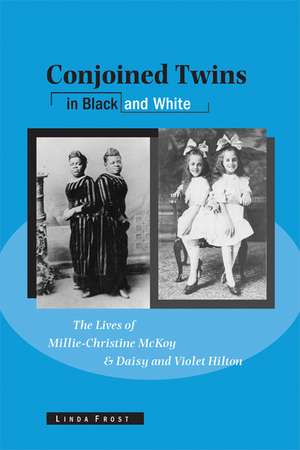 Conjoined Twins in Black and White: The Lives of Millie-Christine McKoy and Daisy and Violet Hilton de Linda Frost