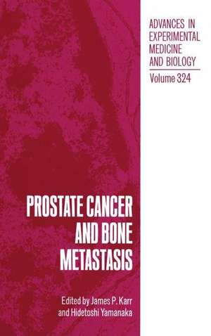 Prostate Cancer and Bone Metastasis de James P. Karr