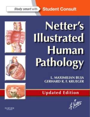 Netter's Illustrated Human Pathology Updated Edition: with Student Consult Access de L. Maximilian Buja