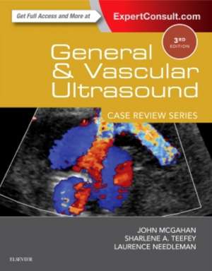 General and Vascular Ultrasound: Case Review de John P. McGahan