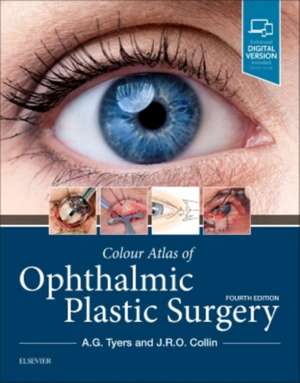 Colour Atlas of Ophthalmic Plastic Surgery de Anthony G. Tyers