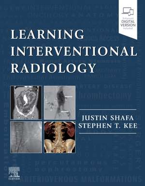 Learning Interventional Radiology de Justin Shafa