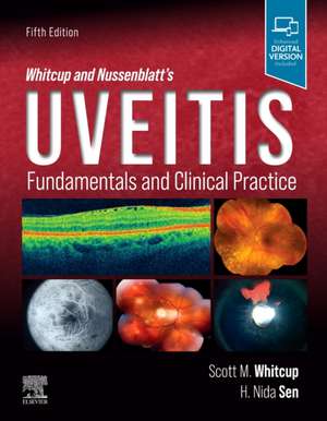 Whitcup and Nussenblatt's Uveitis: Fundamentals and Clinical Practice de Scott M. Whitcup