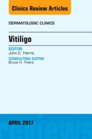 Vitiligo, An Issue of Dermatologic Clinics de John E. Harris