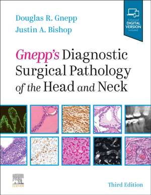 Gnepp's Diagnostic Surgical Pathology of the Head and Neck de Douglas R. Gnepp