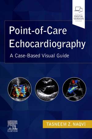 Point-of-Care Echocardiography: A Clinical Case-Based Visual Guide de Tasneem Z. Naqvi