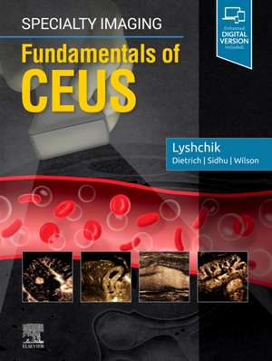 Specialty Imaging: Fundamentals of CEUS de Andrej Lyshchik