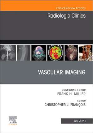 Vascular Imaging, An Issue of Radiologic Clinics of North America de Christopher J François