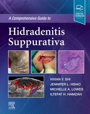 A Comprehensive Guide to Hidradenitis Suppurativa de Vivian Y. Shi