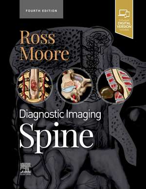 Diagnostic Imaging: Spine de Jeffrey S. Ross