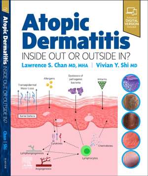 Atopic Dermatitis: Inside Out or Outside In de Lawrence S. Chan