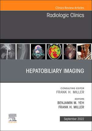 Hepatobiliary Imaging, An Issue of Radiologic Clinics of North America de Benjamin M. Yeh