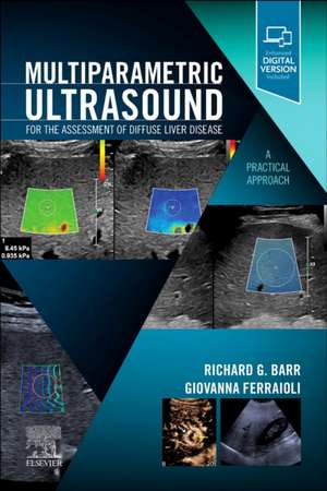 Multiparametric Ultrasound for the Assessment of Diffuse Liver Disease: A Practical Approach de Richard G. Barr