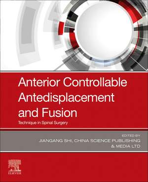 Anterior Controllable Antedisplacement and Fusion: Technique in Spinal Surgery de Jiangang Shi